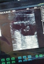 Baby goat on ultrasound. Baby goat on ultrasound.